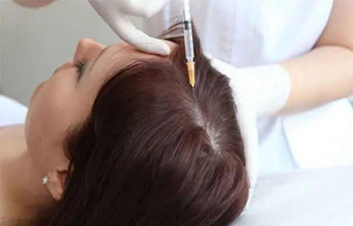 كيف تساعد البلازما (PRP) في تكثيف الشعر؟