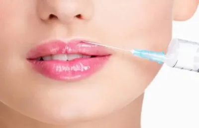 فيلر الشفاه ونصائح للحصول على امتلاء طبيعي
